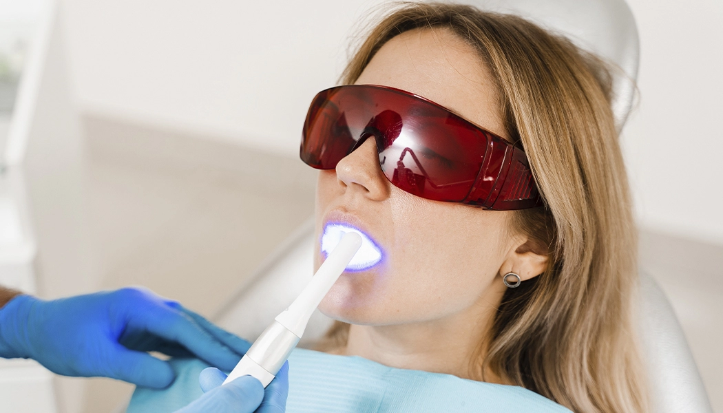 фото:Осветление эмали зубов лазером::Отбеливание зубов лазером