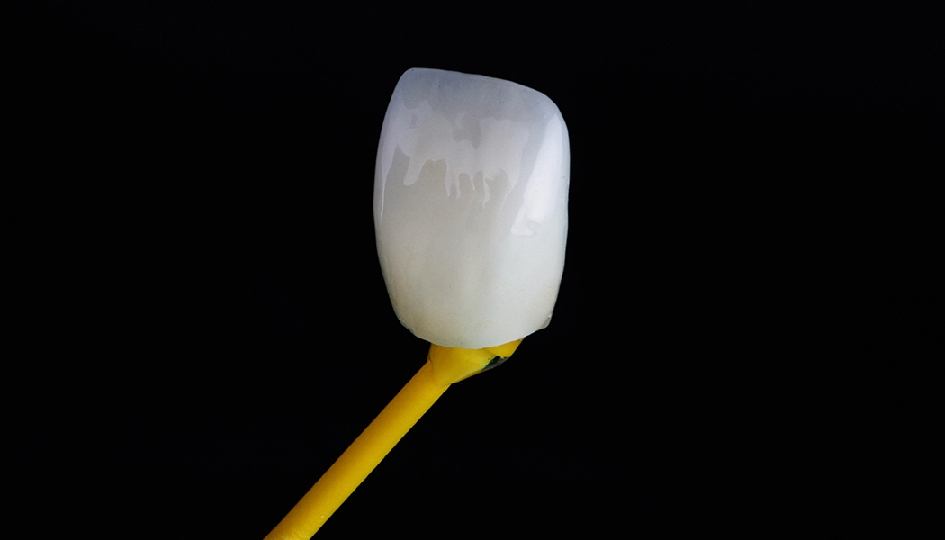 фото:Установка коронок под микроскопом::Обточка под коронку под контролем микроскопа