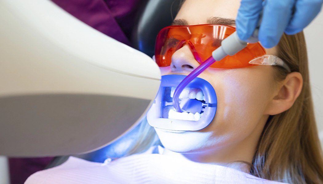 фото:Отбеливание зубов Опалесенс::Профессиональное отбеливание зубов Opalescence