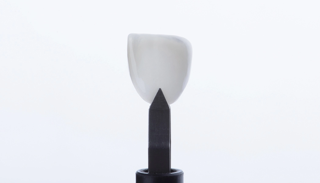 фото:Установка микропротезов под микроскопом::Обточка под виниры под контролем микроскопа